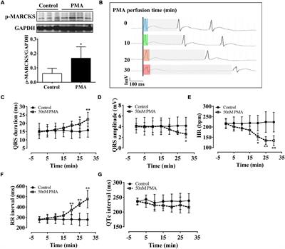 Protein Kinase C-Mediated Hyperphosphorylation and Lateralization of Connexin 43 Are Involved in Autoimmune Myocarditis-Induced Prolongation of QRS Complex